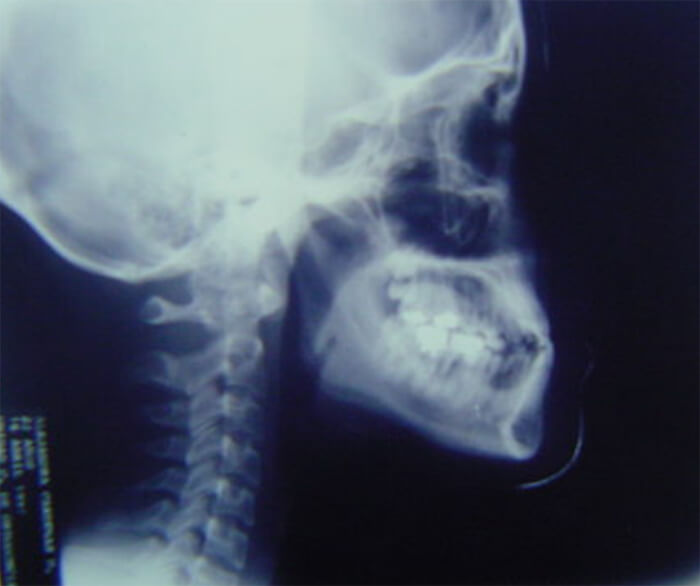 Fig. 9