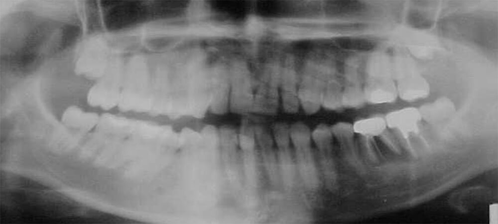 Fig. 10