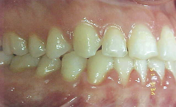 Fig. 22