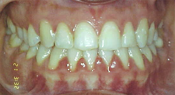 Fig. 23