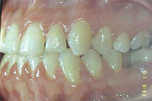 Fig. 24