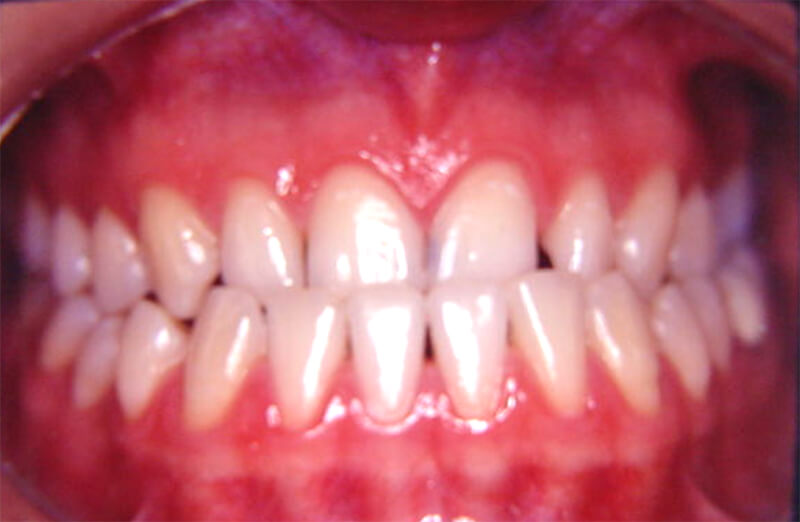 Fig. 36 INICIAL