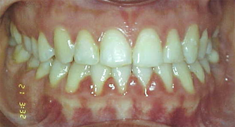 Fig. 37 FINAL