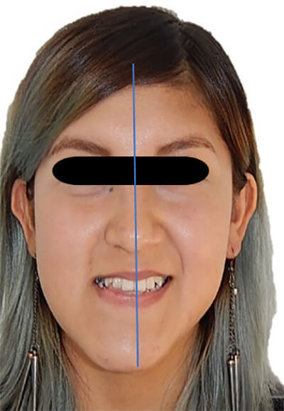 Fig. 2 frente sonrisa