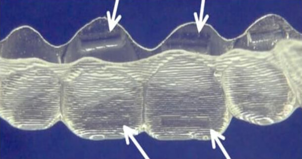 Figura 6: Power ridges, “Alineadores Invisibles” tomado de la “Revisión histórica de la técnica invisalign”