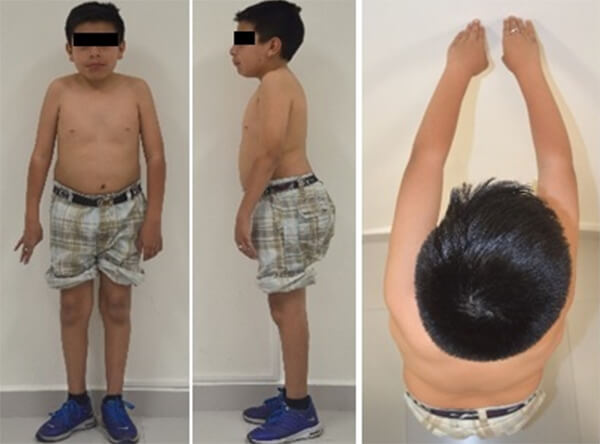 Figura 3. Evaluación de la postura corporal.