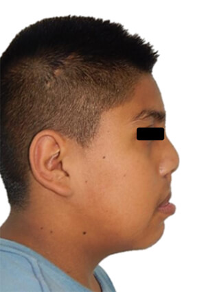 Fig 2 perfil derecho