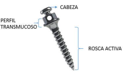 Figura 1 Partes de un minitornillo http://dspace.uan.mx:8080/bitstream/123456789/956/1/tam221-07.pdf