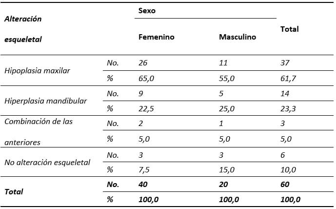 Tabla # 4. Distribución de pacientes Clase III por sexo y tipo de alteración esqueletal. 