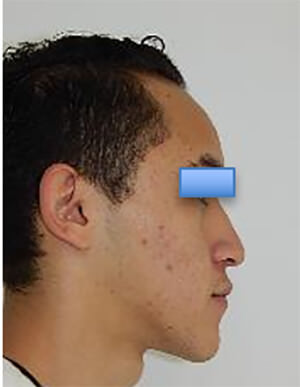 Fig. 2 lateral extraoral