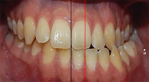 Fig. 4 frente intraoral