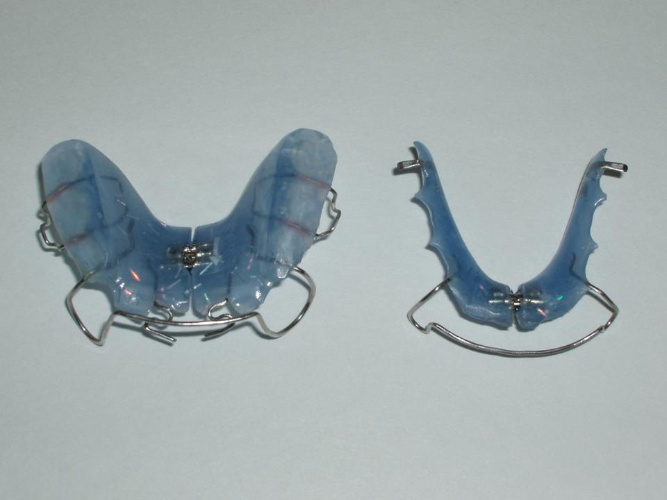 Fig.8: Placa progenie superior y placa activa inferior, con tornillo para expansión transversal.