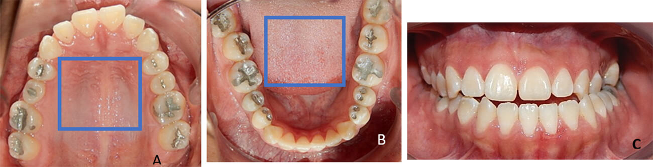 Fig. 5 Oclusal superior A, inferior B, frente C