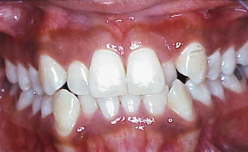 Fig. 3 Vista intraoral frontal
