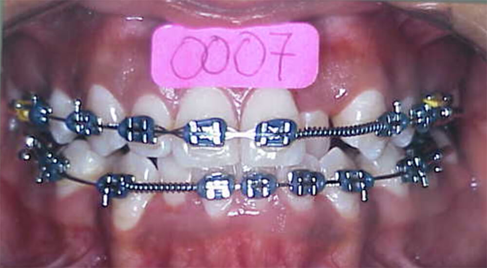 Fig. 11