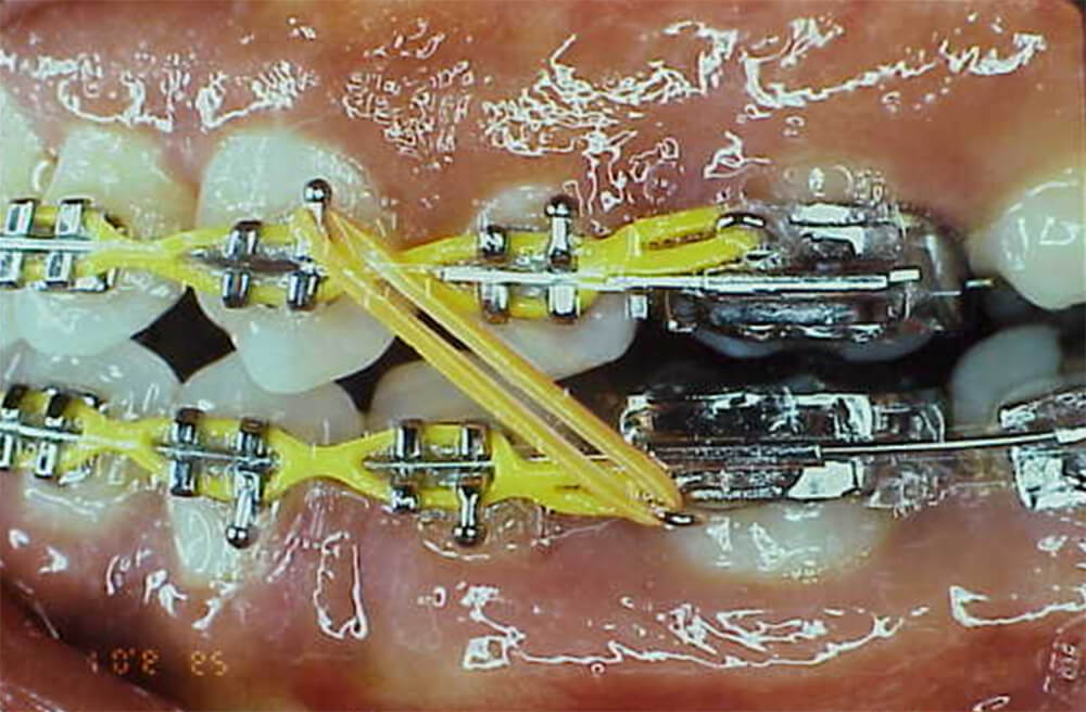 Fig. 15