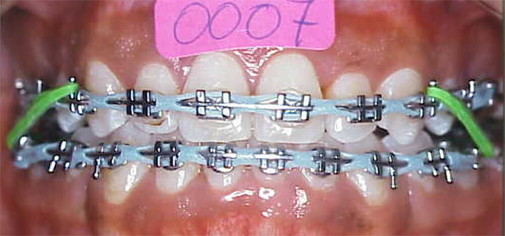 Fig. 16