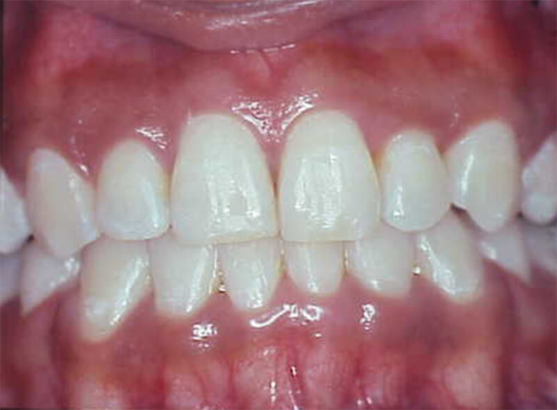 Fig. 20