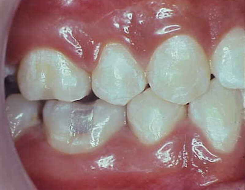Fig. 21