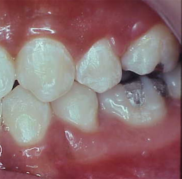 Fig. 22