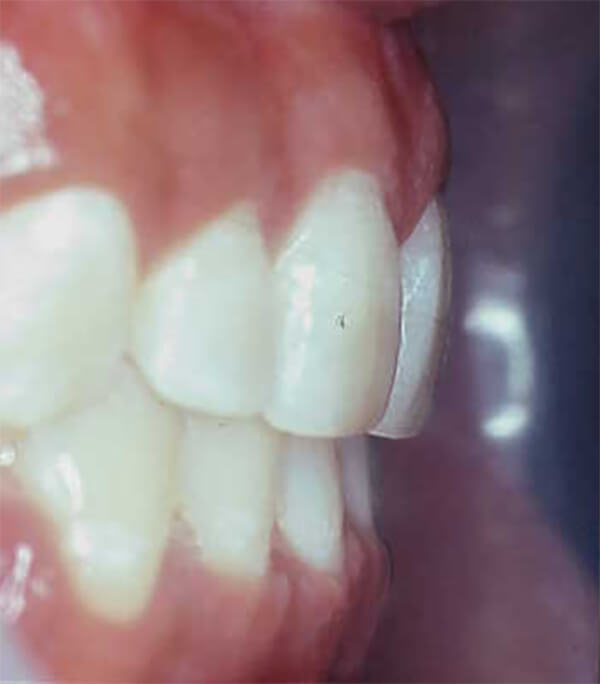 Fig. 23