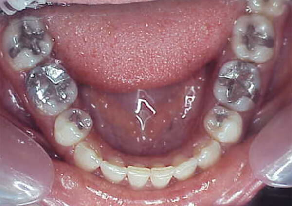 Fig. 25