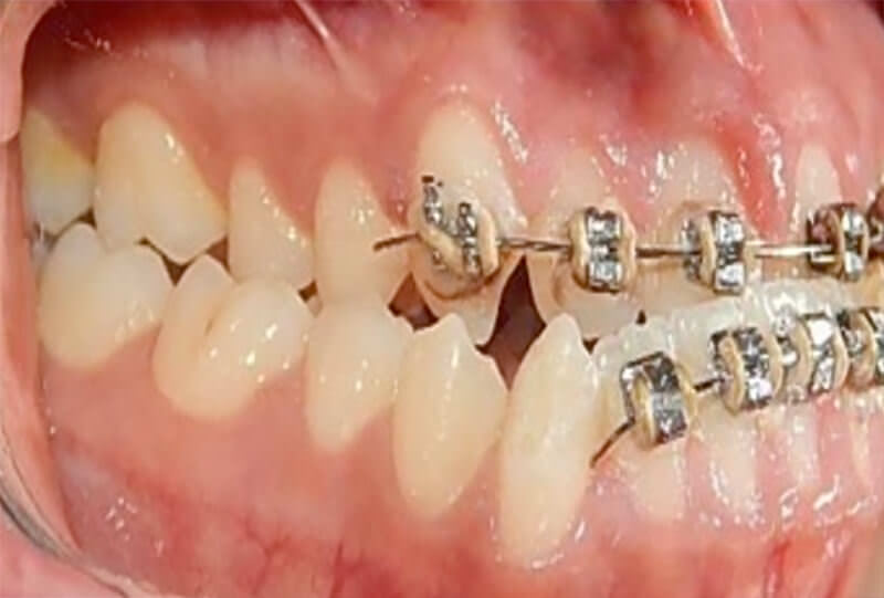 Fig. 7 derecha