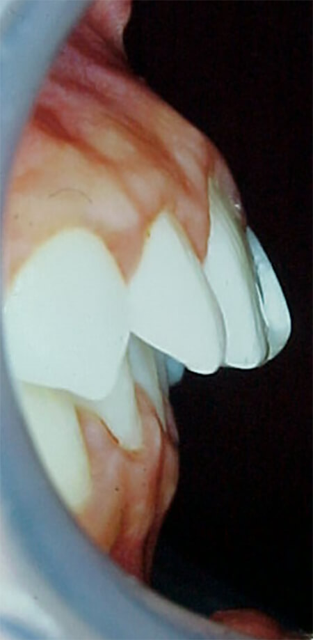 Fig. 8