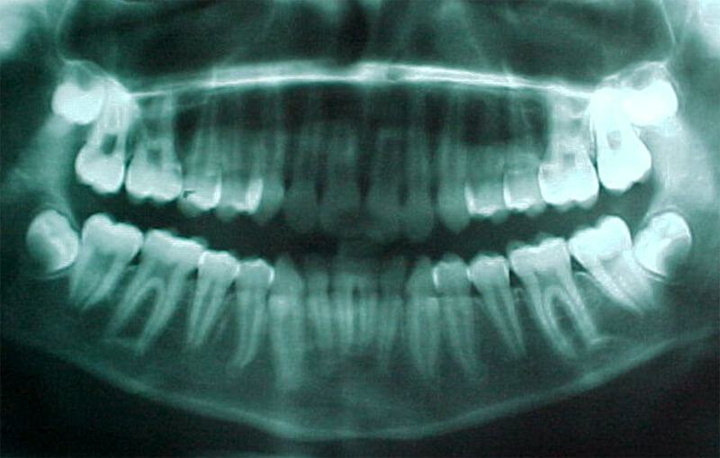 Fig. 9