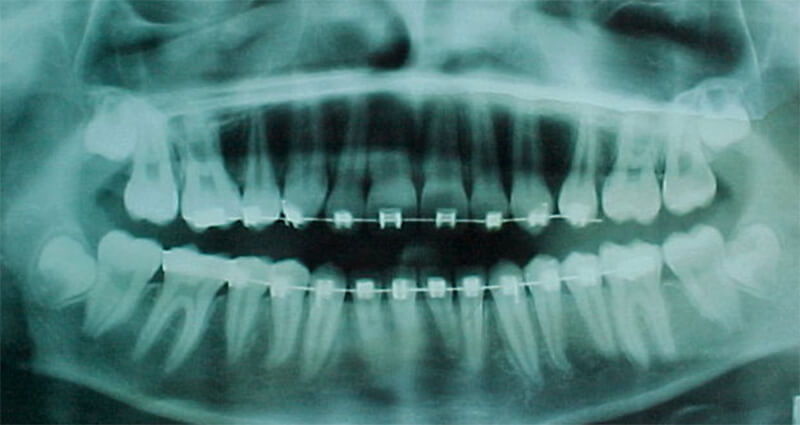 Fig. 17