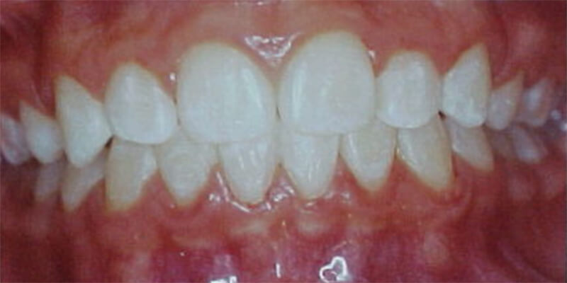 Fig. 21