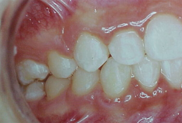 Fig. 22