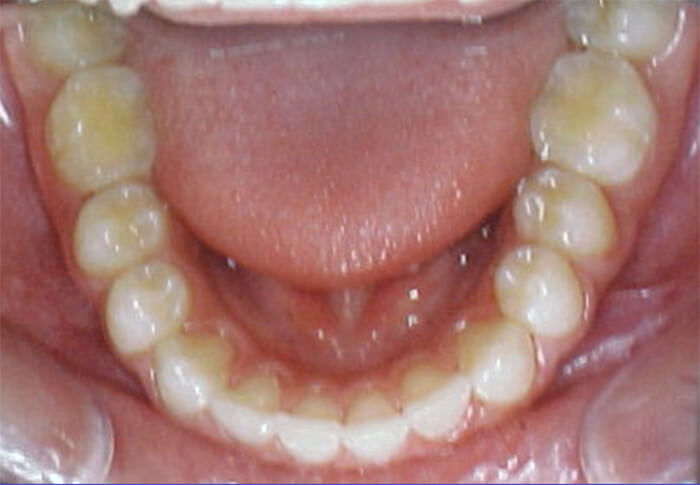 Fig. 25