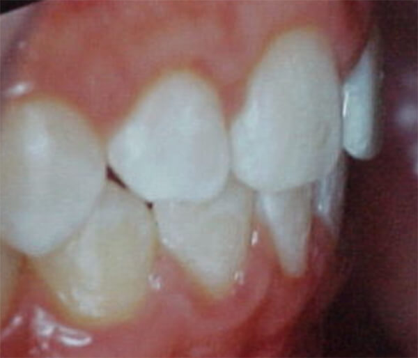 Fig. 26