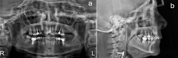Figura 9.- Radiografías Finales. a) Panorámica b) Telerradiografía lateral.