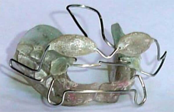 Figura 1 AAE para el tratamiento de Clase III Fuente: Otaño L.R. Manual Clínico de Ortodoncia.14