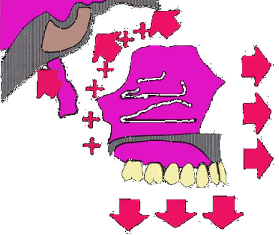 Fig. 4. Desplazamiento y crecimiento del maxilar en sentido sagital y vertical. Fuente. Ordóñez (1984)