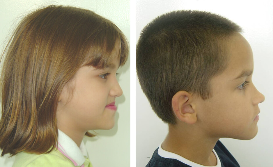 Fig. 13. Evaluación del perfil.