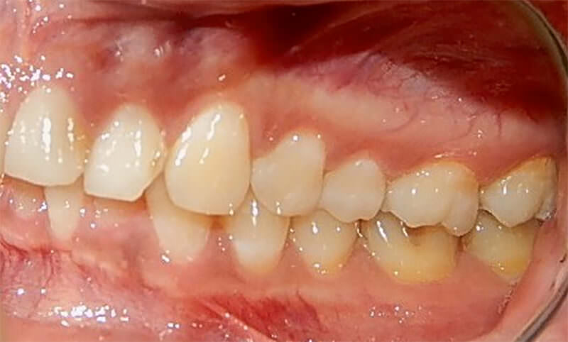 Fig. 6 Izquierda