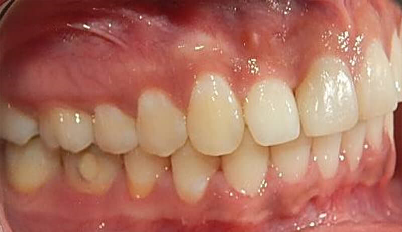 Fig. 21 derecha