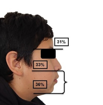 Fig. 15. perfil