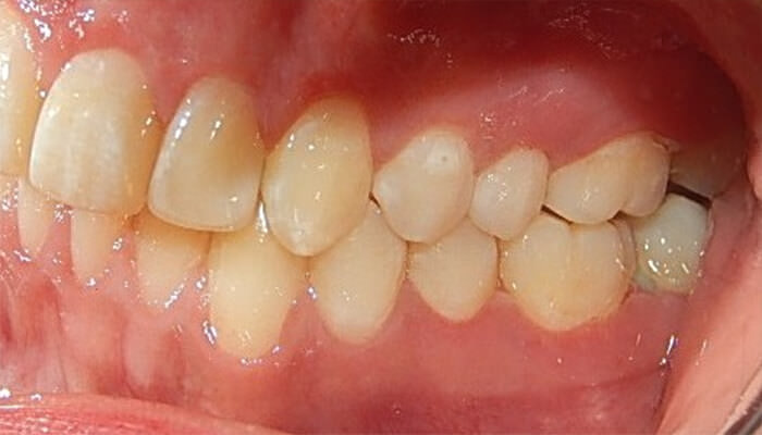 Fig.17 lateral izquierda