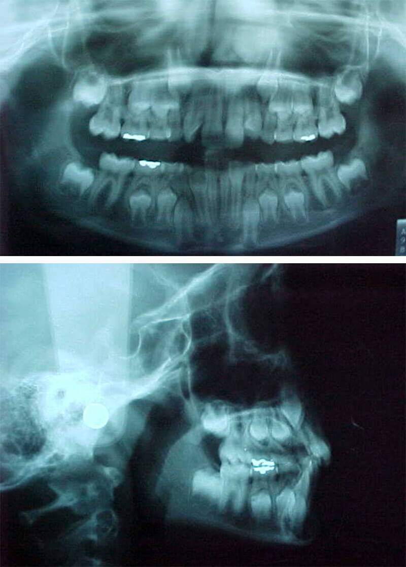 Fig. 8 y 9