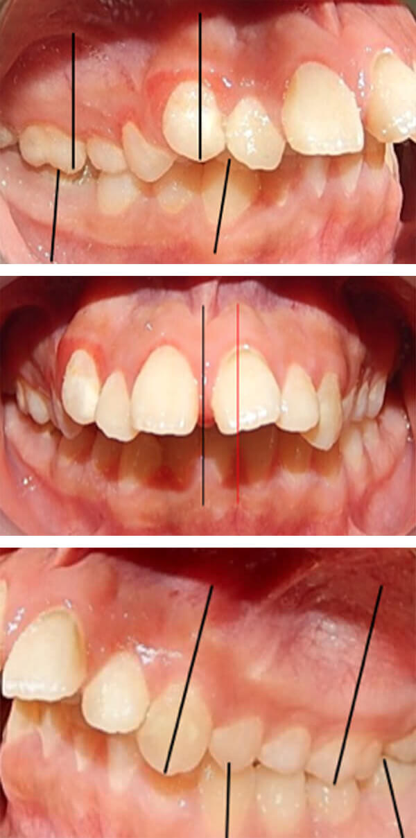 Fig. 4 Lateral derecha, de frente y lateral izquierda