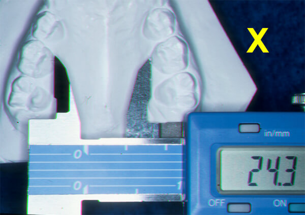 ANALISIS DE BOGUE (Primer Control)