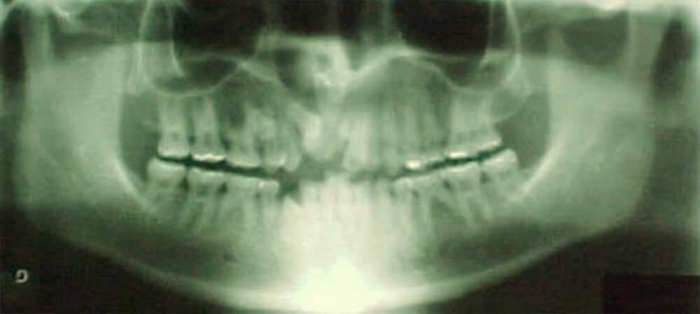 Fig. 9 Radiografía panorámica