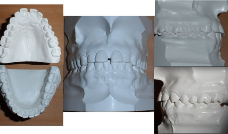 Figura 5. Modelos de estudio