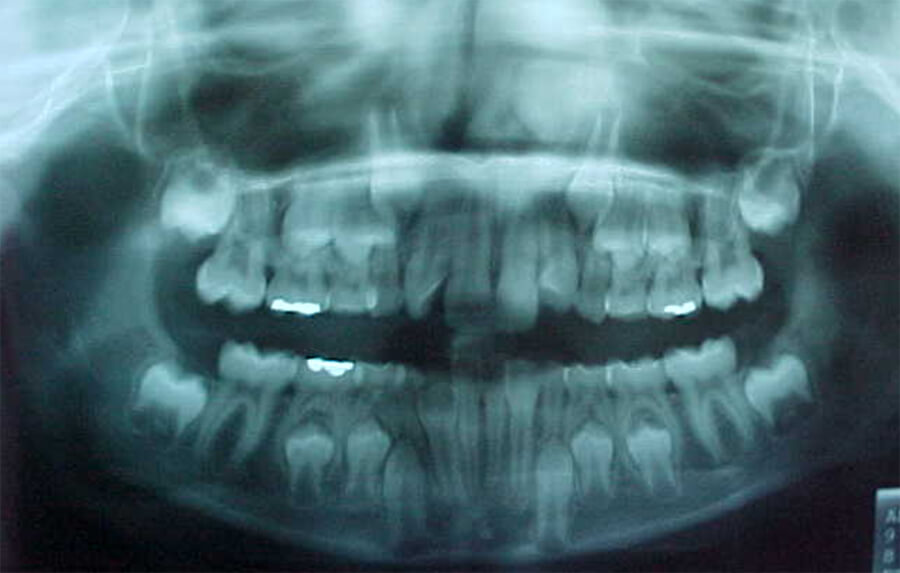 Fig. 8