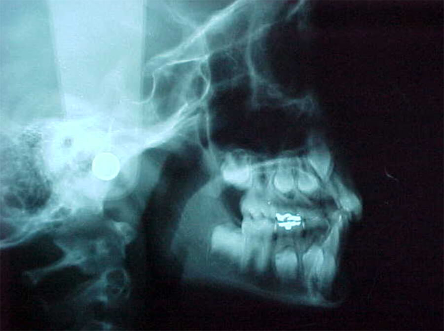 Fig. 9