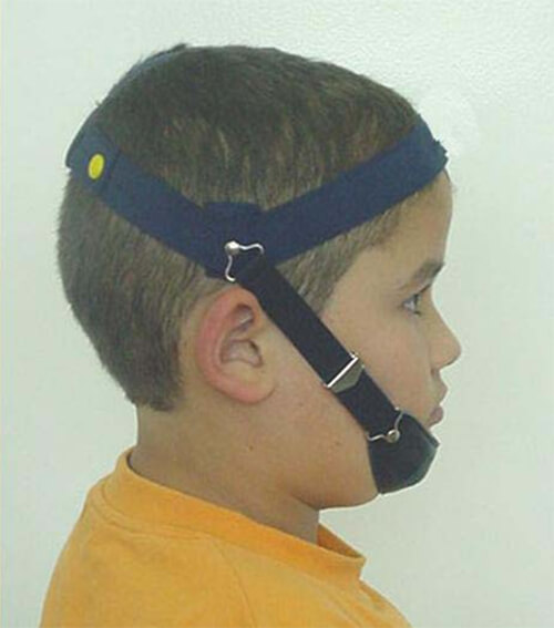 Fig.7 Paciente tratado con mentonera